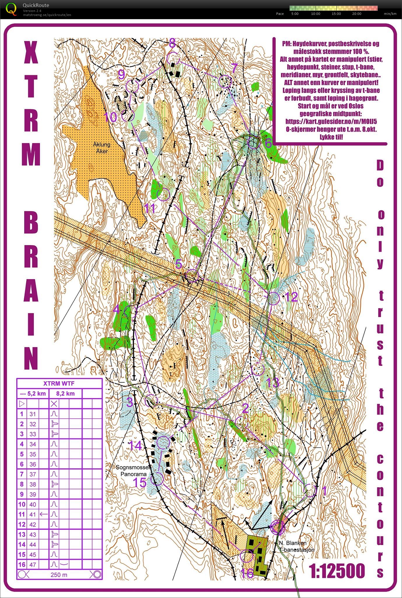 xtrm brain (05.10.2017)